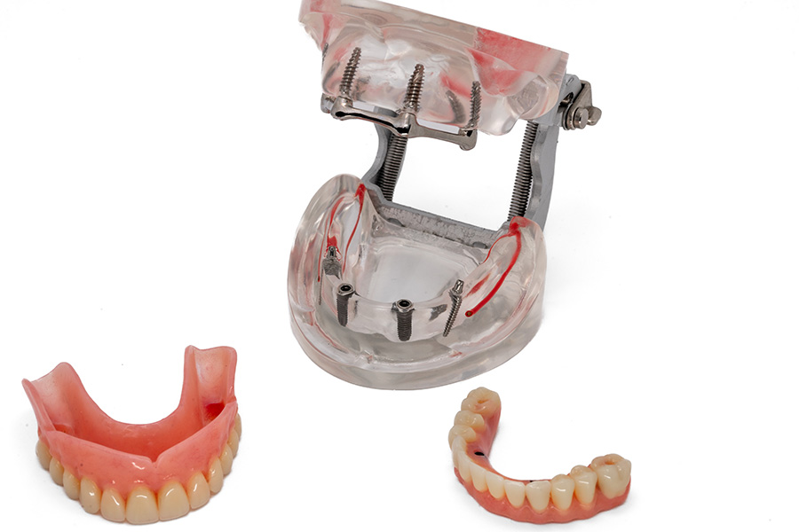 ESPLICO – Il Modello