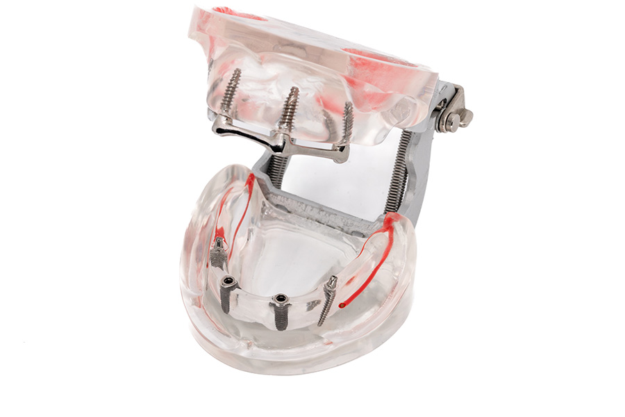 ESPLICO – Il Modello