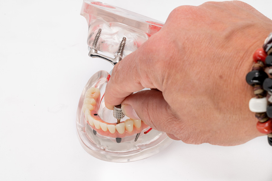 ESPLICO – Il Modello