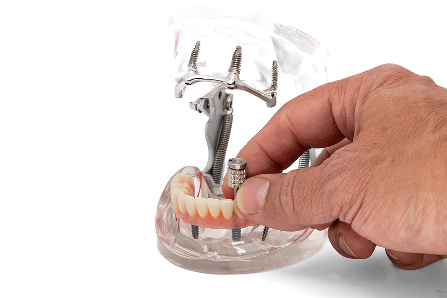 ESPLICO – Il Modello