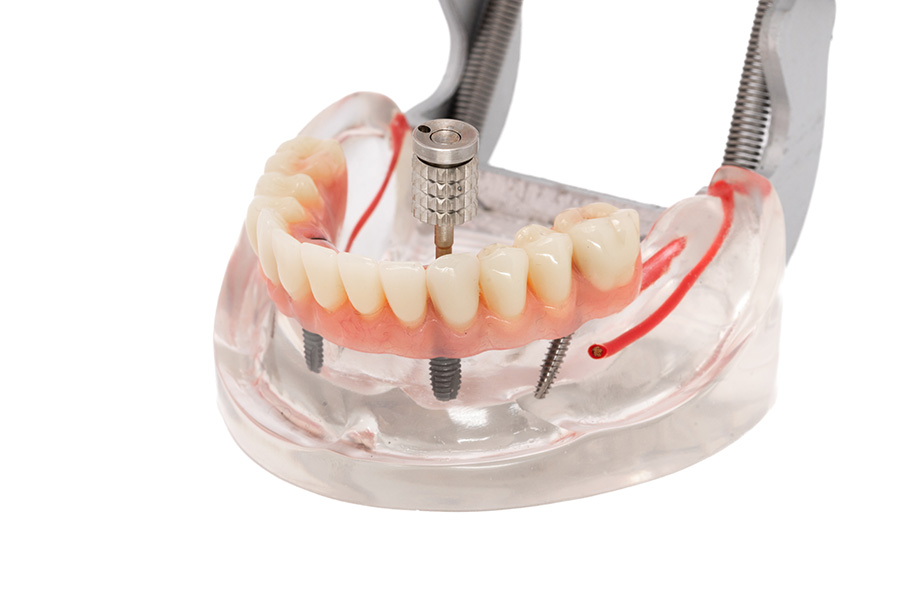 ESPLICO – Il Modello