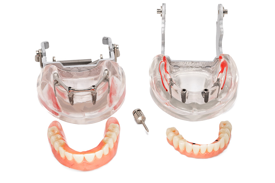 ESPLICO – Il Modello