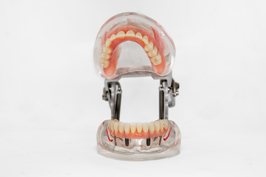 ESPLICO – Il Modello