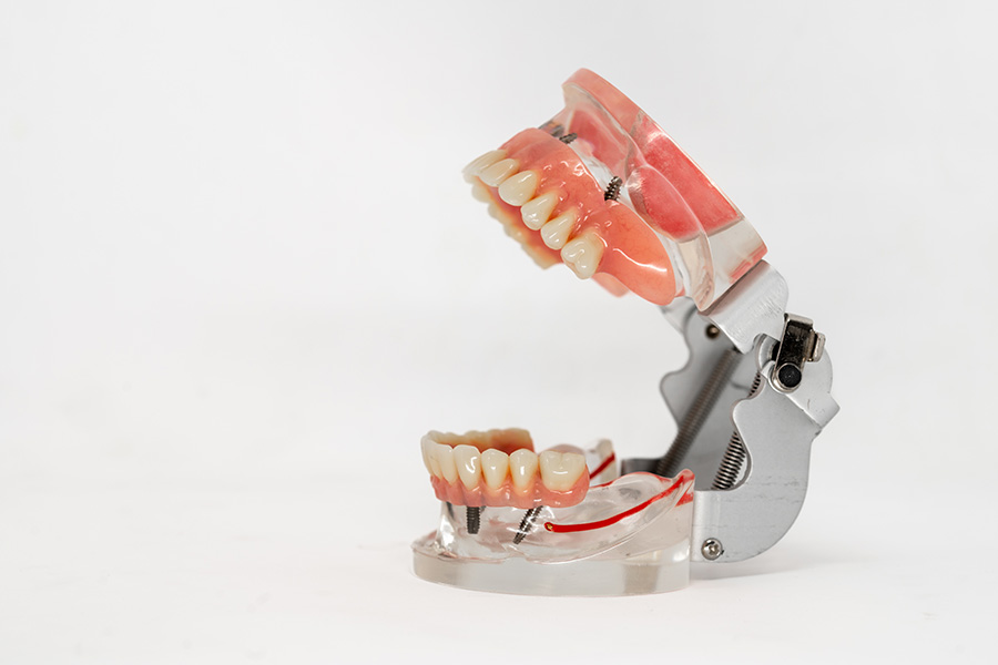 ESPLICO – Il Modello