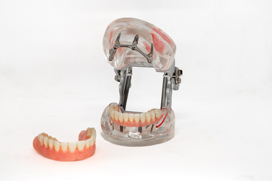 ESPLICO – Il Modello