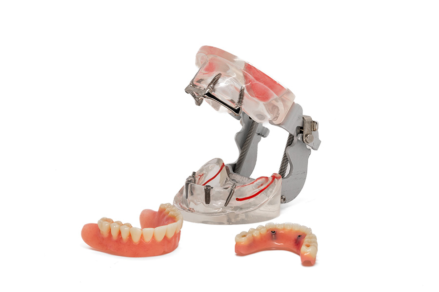 ESPLICO – Il Modello