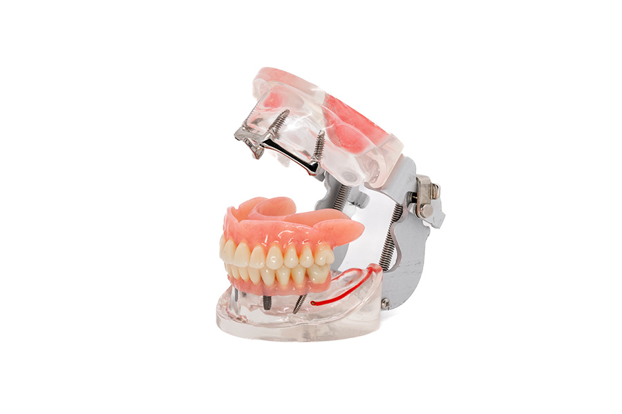 ESPLICO – Il Modello