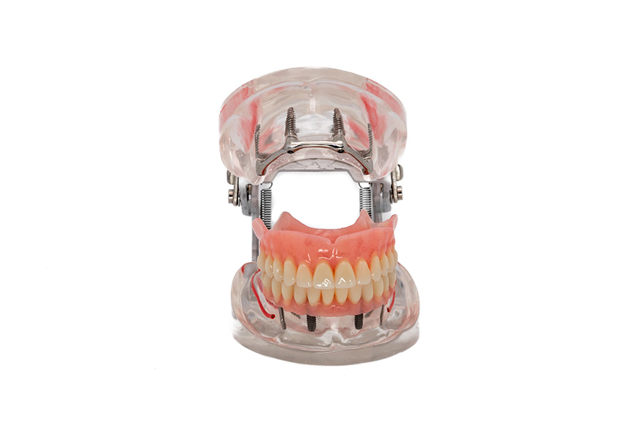 ESPLICO – Il Modello