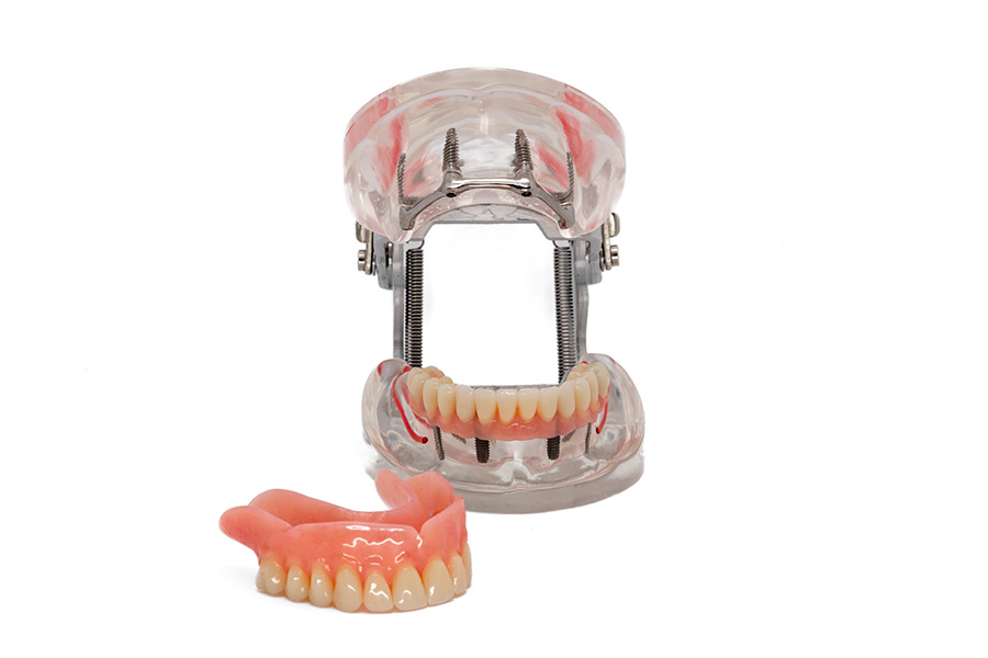 ESPLICO – Il Modello