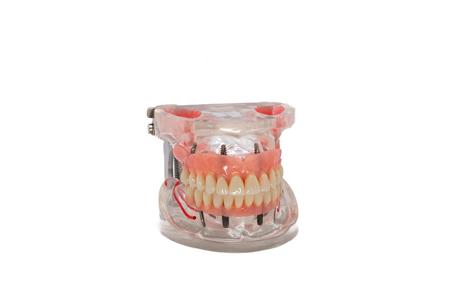 ESPLICO – Il Modello